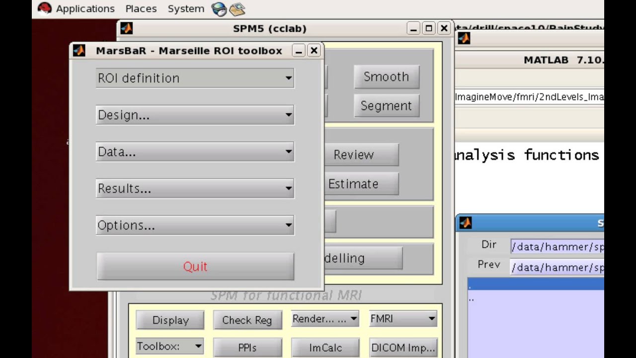 SPM MarsBar Tutorial: Creating ROIs from Coordinates