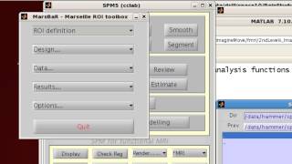 SPM MarsBar Tutorial: Creating ROIs from Coordinates