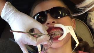 GABRIELLE GETS BRACES | EPISODE 12