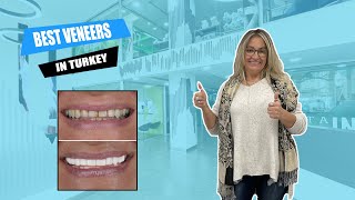 Why should you get FULL SET OF VENEERS in Turkey? | Myra Dental Centre Turkey 🦷