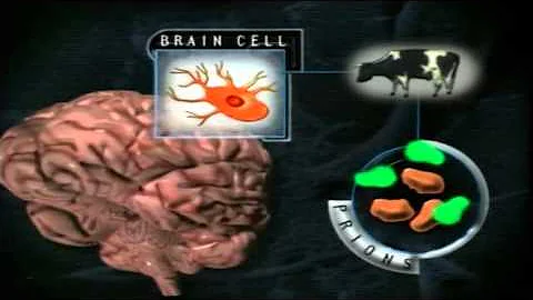 Forensic Files Foreign Body Part 2 of 3
