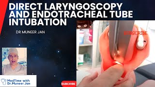 Direct Laryngoscopy  By Dr Muneer Jan