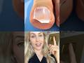 Why THIS might be causing ingrown toenails (@zackdfilms)