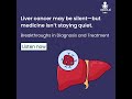 "Liver cancer may be silent but medicine isn’t staying quiet