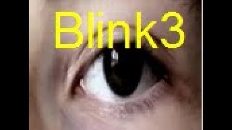 Eye Blink Detction in MATLAB