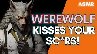 Download Lagu Werewolf Kisses Your Sc*rs!  ASMR Boyfriend [M4F/M4A] MP3