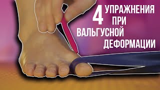 4 Упражнения При Вальгусной Деформации