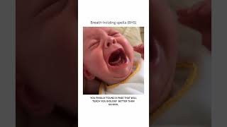 Breath-Holding Spells – Short TheoryBreath-holding spells are involuntary episodes seen in childrn