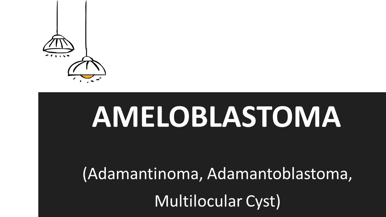 Ameloblastoma Clinical Features and Treatment of Ameloblastoma YouTube