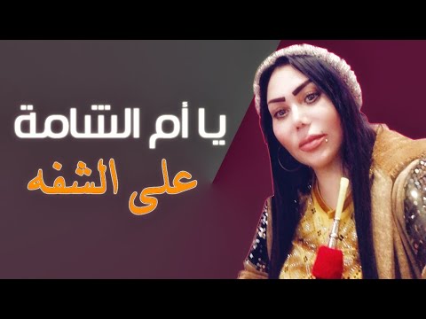 يا ام الشامة على الشفة دلع الشيهانة دبكا إقلاعية