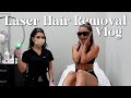 My fullbody laser hair removal journey  watch before you start vlog  qa