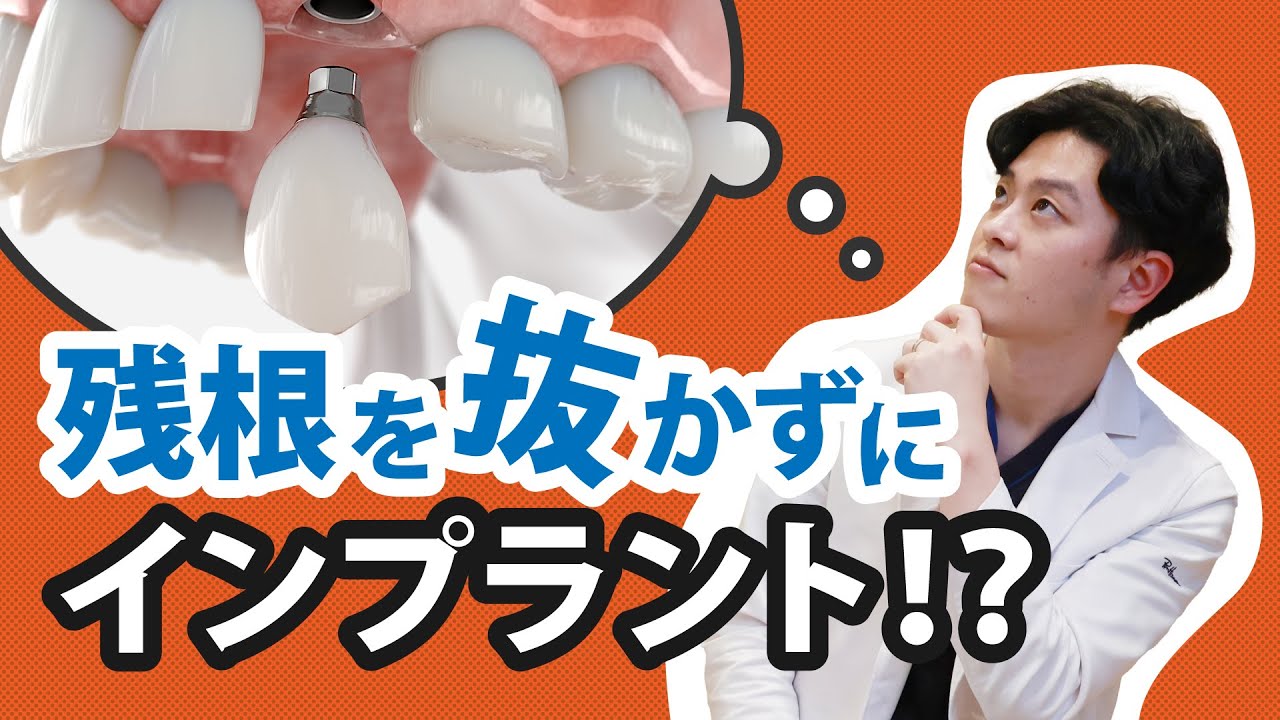 GBR】吸収性か非吸収性か？メンブレンの歴史とトレンドについて解説