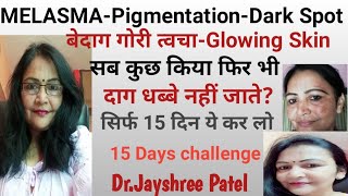 MELASMA-Pigmentation-Dark Spots||आप सब कुछ करके थक गए हो? तो सिर्फ 15 दिन ये कर लो 15 days challenge screenshot 2