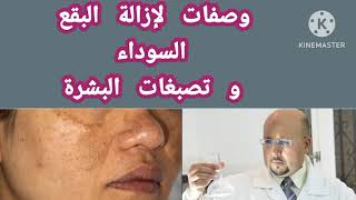 وصفات لإزالة البقع السوداء و تصبغات البشرة من عند الدكتور عماد ميزاب .