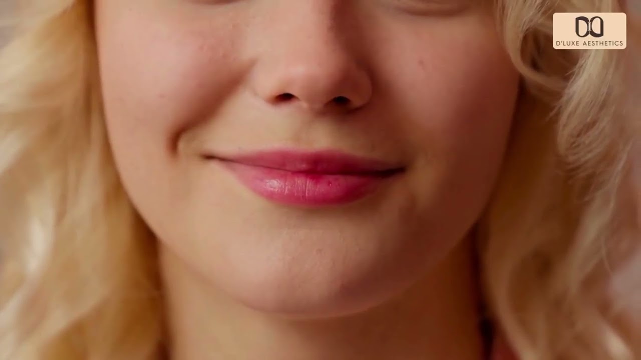 How Lip Fillers Work | Dallas, TX Aesthetic Breakdown