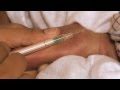 Newborn Care Series: Taking a Heel Blood Sample - YouTube