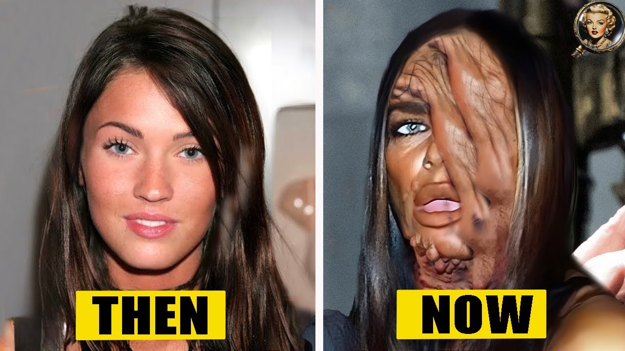 18 Disastrous Plastic Surgeries of Celebrities THEN and NOW | Then and Now 2026