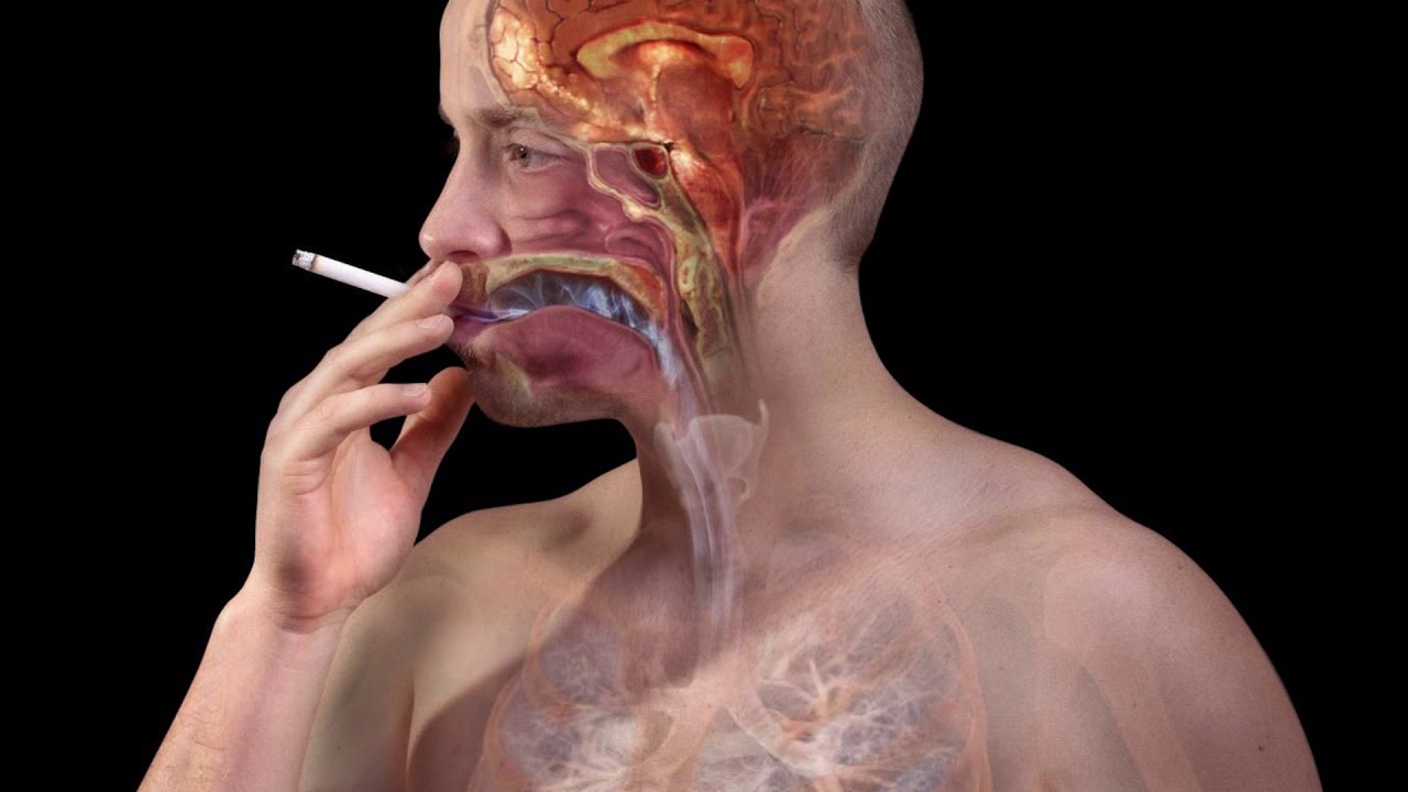 მოწევა მავნებელია ჯანმრთელობისთვის - პრივატ კლინიკა