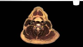 Cervical Plexus Block - Understanding the Cervical Nerves Pathway Pt 1.