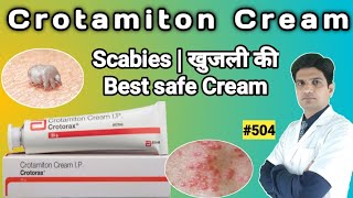 Crotamiton cream i.p crotorax | Crotorax cream uses | Crotorax cream uses in hindi