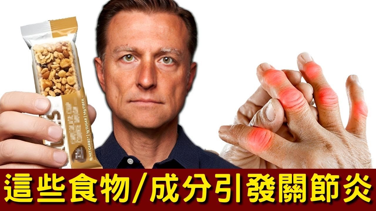 關節炎患者的飲食地雷！7大禁忌食物 vs 最佳療癒飲食