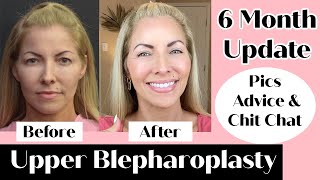 Upper Blepharoplasty 6 month Update | Upper Eyelid Surgery | 50 Yrs Old | Pics Advice & Chit Chat by Jenifer Jenkins 10,794 views 7 months ago 42 minutes