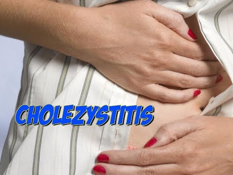 Video: Chronische Cholezystitis - Symptome, Behandlung, Ernährung, Anzeichen