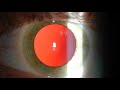Color de los ojos según la pigmentación del iris y la luz ambiental