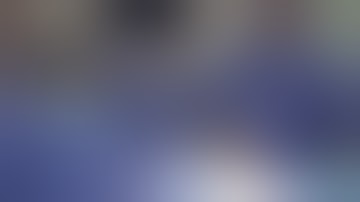 Robotic Port placement Xi transperitoneal kidney access