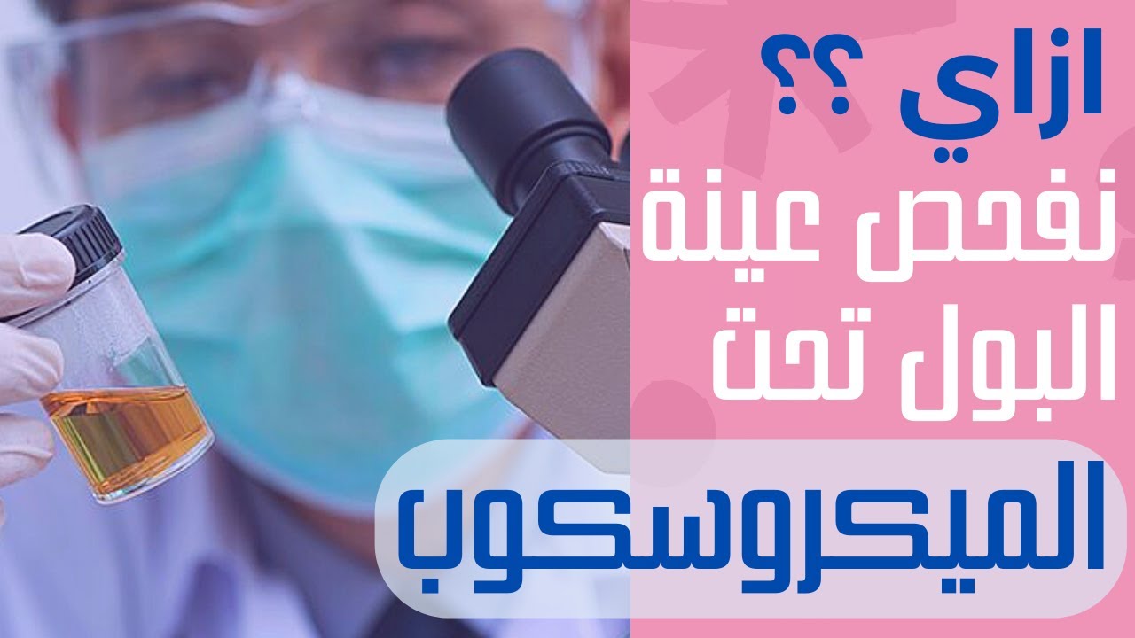 12_مراجعة علي تحليل البول الكامل عملي  والتدريب علي قراءة التقرير