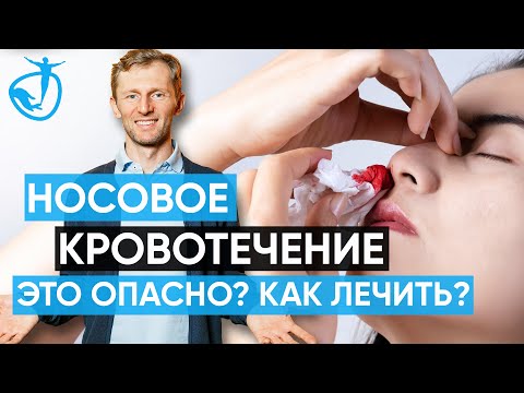 ПРИЧИНЫ НОСОВОГО КРОВОТЕЧЕНИЯ - Как их устранить // Владимир Животов