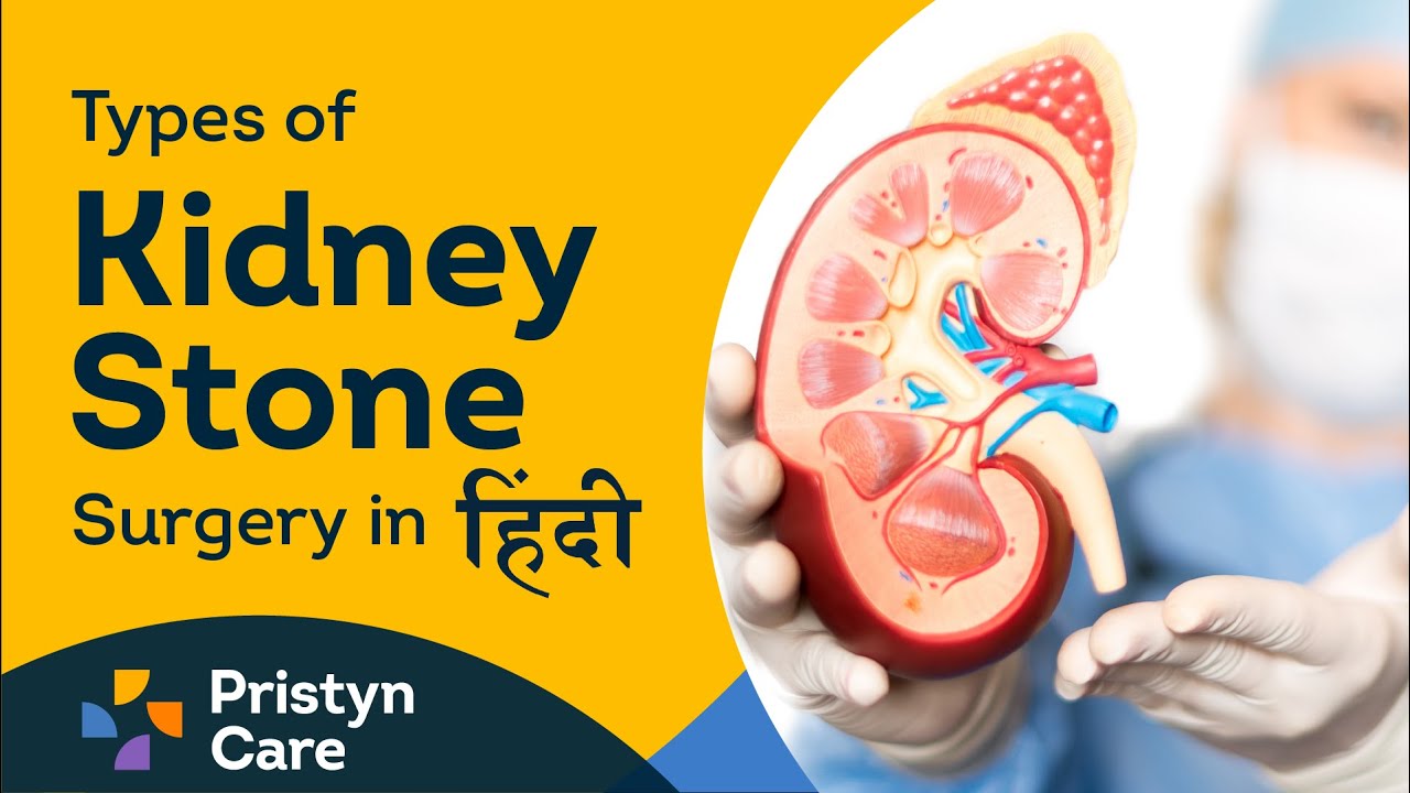 Types of Kidney Stone Surgery in Hindi | Call For Free Consultation - 8065105262