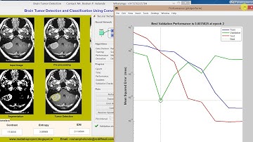 Matlab code for Brain Tumor Detection using Convolutional Neural Network