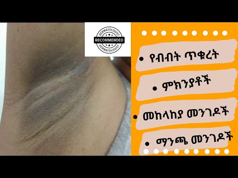 ቪዲዮ: የአዲስ ዓመት ጠረጴዛን በሽንት ጨርቅ እንዴት ማጌጥ እንደሚቻል