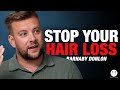 Science Behind Why You Lose Your Hair and How to Fix it | Barnaby Donlon on The TT Podcast