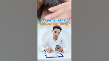 Cấy tóc tự thân có vĩnh viễn không? #lititec #rungtoc #hoidau #dieutrirungtoc #caytoctuthan