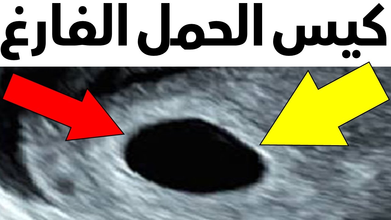 كيس الحمل الفارغ 