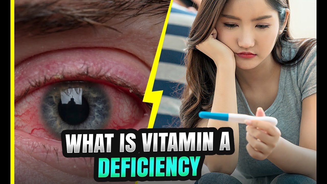 5 Surprising Signs of Vitamin A Deficiency YouTube