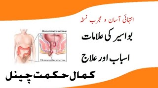 Bawaseer Ka Ilaj.||  بواسیر کا علاج