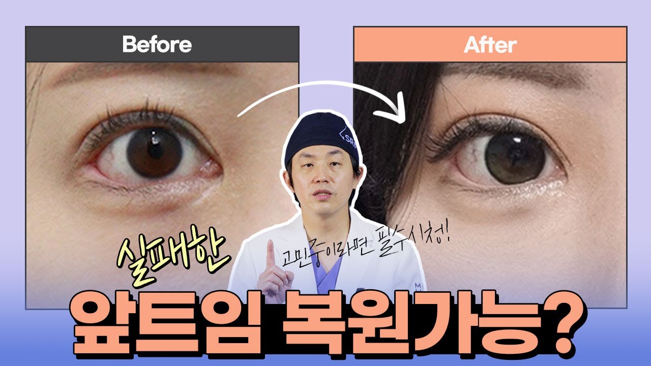 망한 앞트임, 다시 돌아갈 수 있어요  