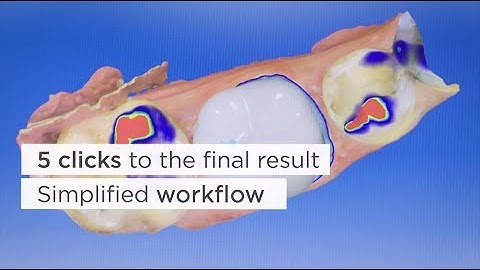 CEREC SW 4.6: Dr. Hendrik Zellerhoff (EN)