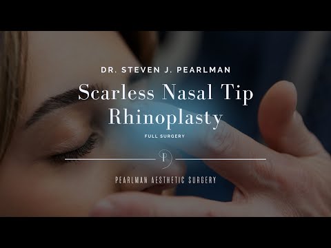 Video thumbnail: Scarless Nasal Tip Rhinoplasty