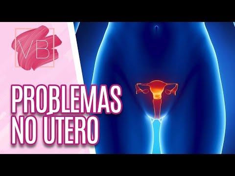 Vídeo: 15 sinais de que você é uma mulher de alta manutenção