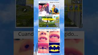 Cuando Sete Callo El Diente Delantero