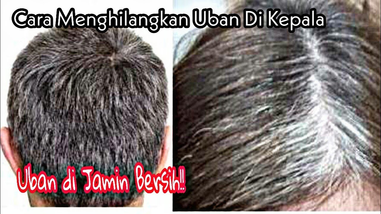 Cara Menghlangkan Uban di usia muda | di Jamin uban Tak Tumbuh lagi