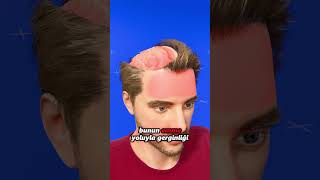 Baş Ağrısına Karşı Halk Yöntemi: Ters Bardak Denemesi 🤕💧