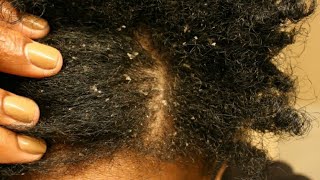 Relaxer retouch when hair is dirty?|Ritach nywele zikiwa chafu?