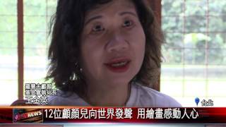20160927 12位顱顏兒向世界發聲 用繪畫感動人心