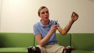 Details Changing skin on your prosthetic hand 😉 News