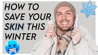 How To Save Your Skin During Winter | Tips and Best Products